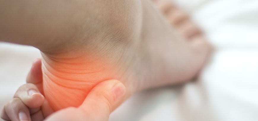 plantar fasciitis orange county ca plantar fasciitis orange county ca
