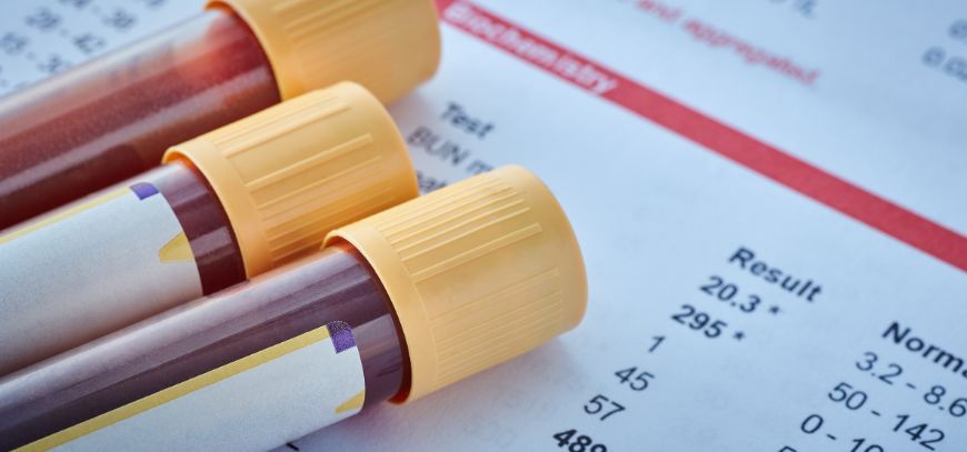 vitamin blood analysis orange county ca vitamin blood analysis orange county ca